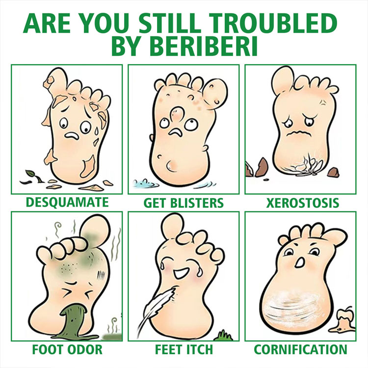اسپری گیاهی ضدبو و درمان زخم پا حجم 30 میلی لیتر